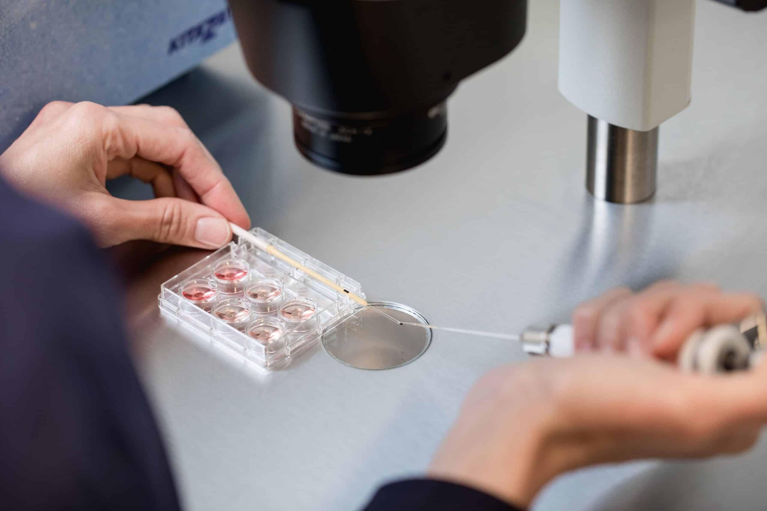 Fecundación In Vitro