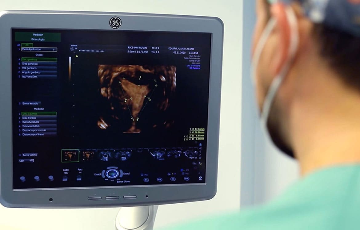 Malformazioni uterine: possono essere trattate chirurgicamente?